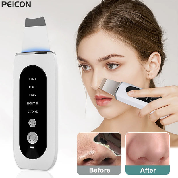 Ultrasonic Face Scrubber Pro - bearfactory